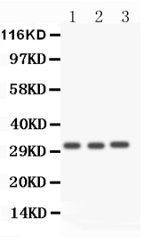 1 - Anti-Caspase 3 Antibody ABO11880
