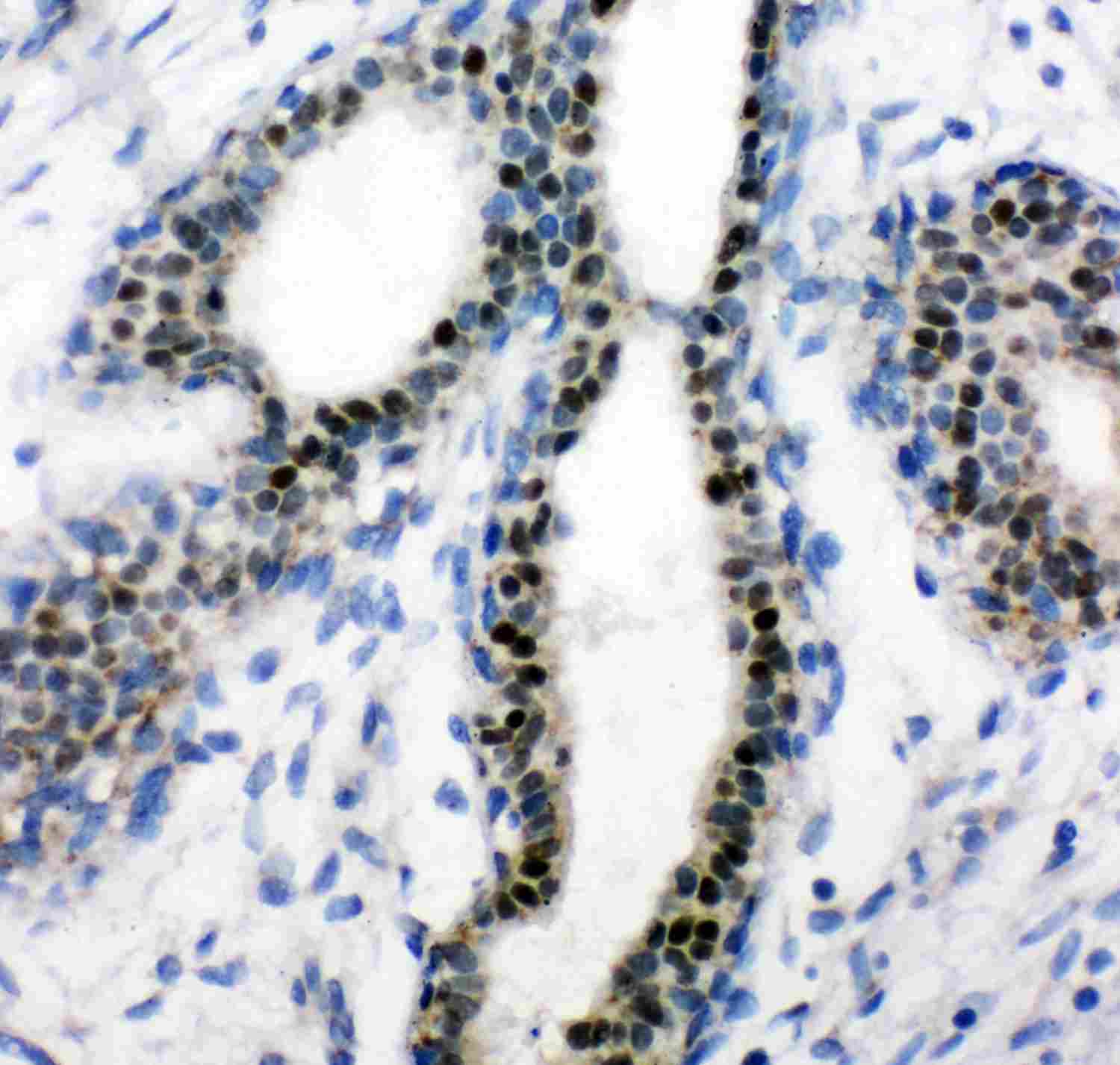 2 - Anti-Estrogen Receptor Picoband Antibody ABO11883