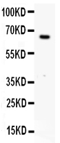 1 - Anti-Estrogen Receptor Picoband Antibody ABO11883