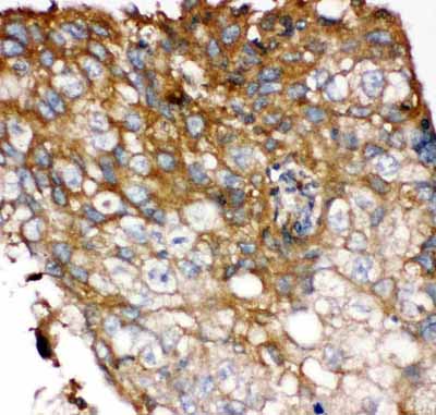 2 - Anti-FGFR4 Picoband Antibody ABO11884
