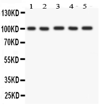 1 - Anti-FGFR4 Picoband Antibody ABO11884