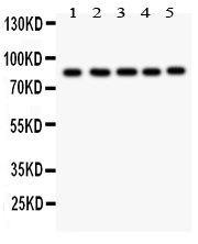 1 - Anti-FOXM1 Picoband Antibody ABO11885