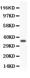 1 - Anti-FOXM1 Picoband Antibody ABO11885