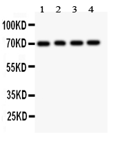 1 - Anti-FOXO1A Picoband Antibody ABO11886
