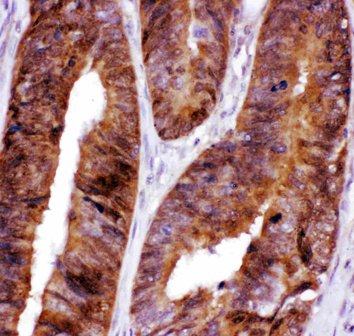 2 - Anti-FOXO3A Picoband Antibody ABO11887