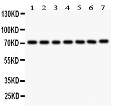 1 - Anti-FOXO3A Picoband Antibody ABO11887