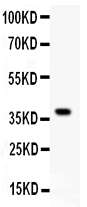 1 - Anti-G6PD Picoband Antibody ABO11889
