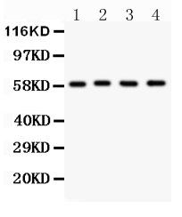 1 - Anti-G6PD Picoband Antibody ABO11889