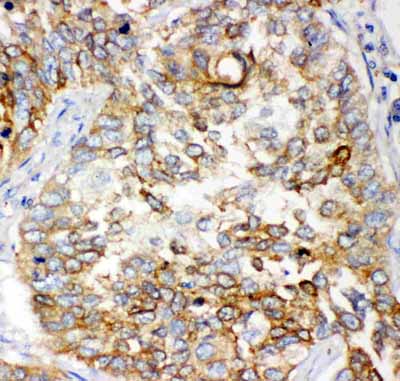 2 - Anti-GCLC Picoband Antibody ABO11892