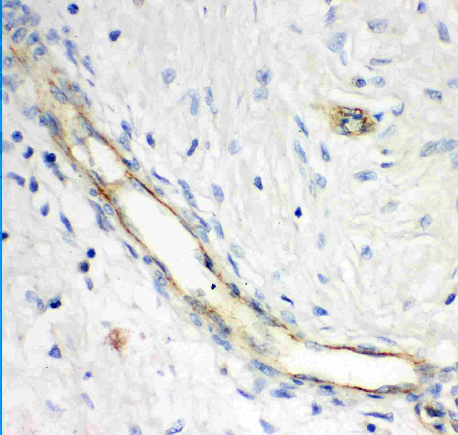 2 - Anti-GCLC Picoband Antibody ABO11892