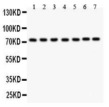 1 - Anti-GCLC Picoband Antibody ABO11892