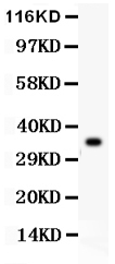 1 - Anti-GPX1 Picoband Antibody ABO11894