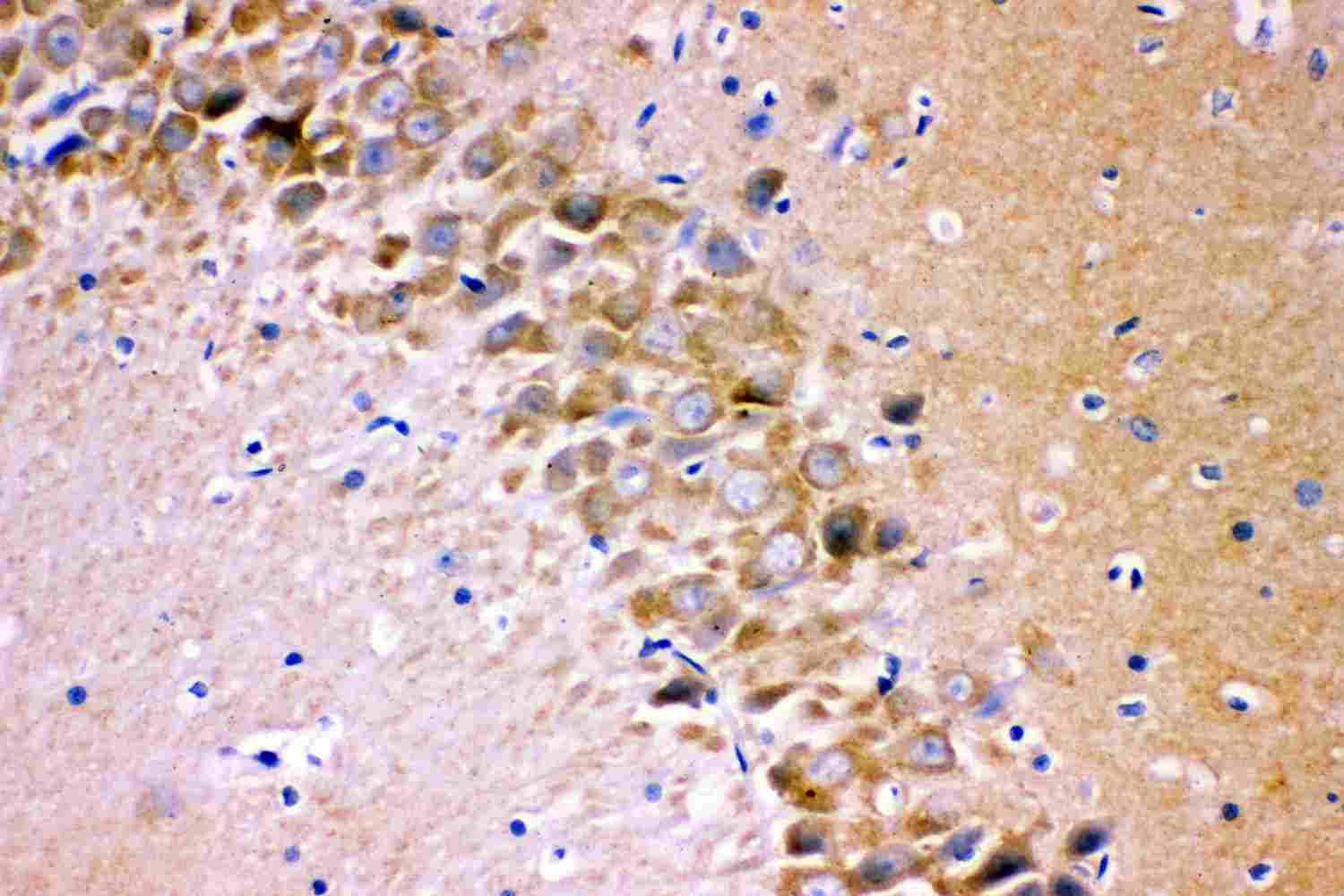 2 - Anti-GRIA1 Picoband Antibody ABO11895
