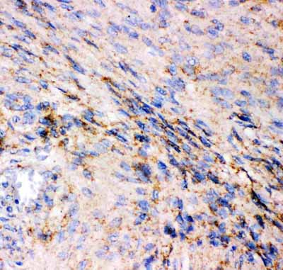 2 - Anti-GRIA1 Picoband Antibody ABO11895