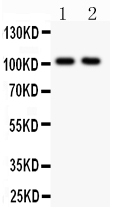 1 - Anti-GRIA1 Picoband Antibody ABO11895