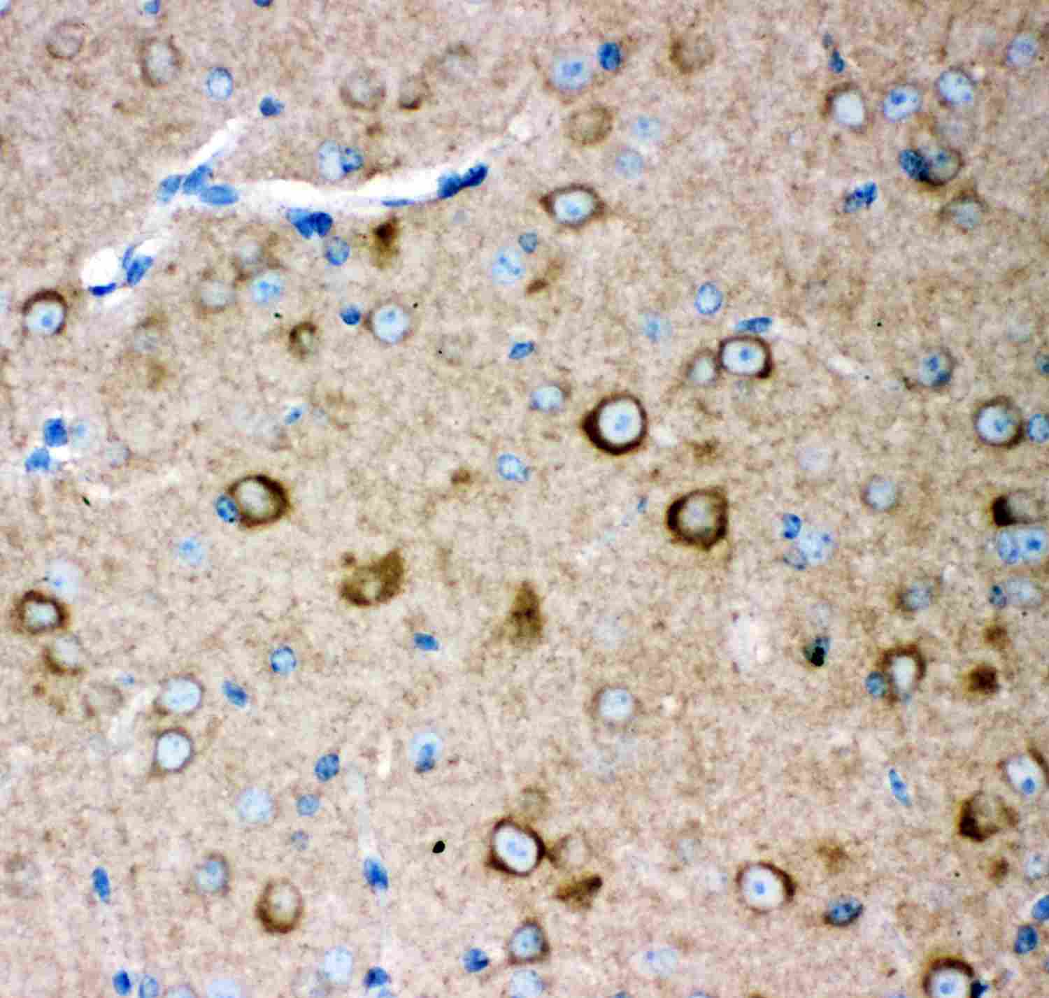 2 - Anti-GRIA2 Picoband Antibody ABO11896