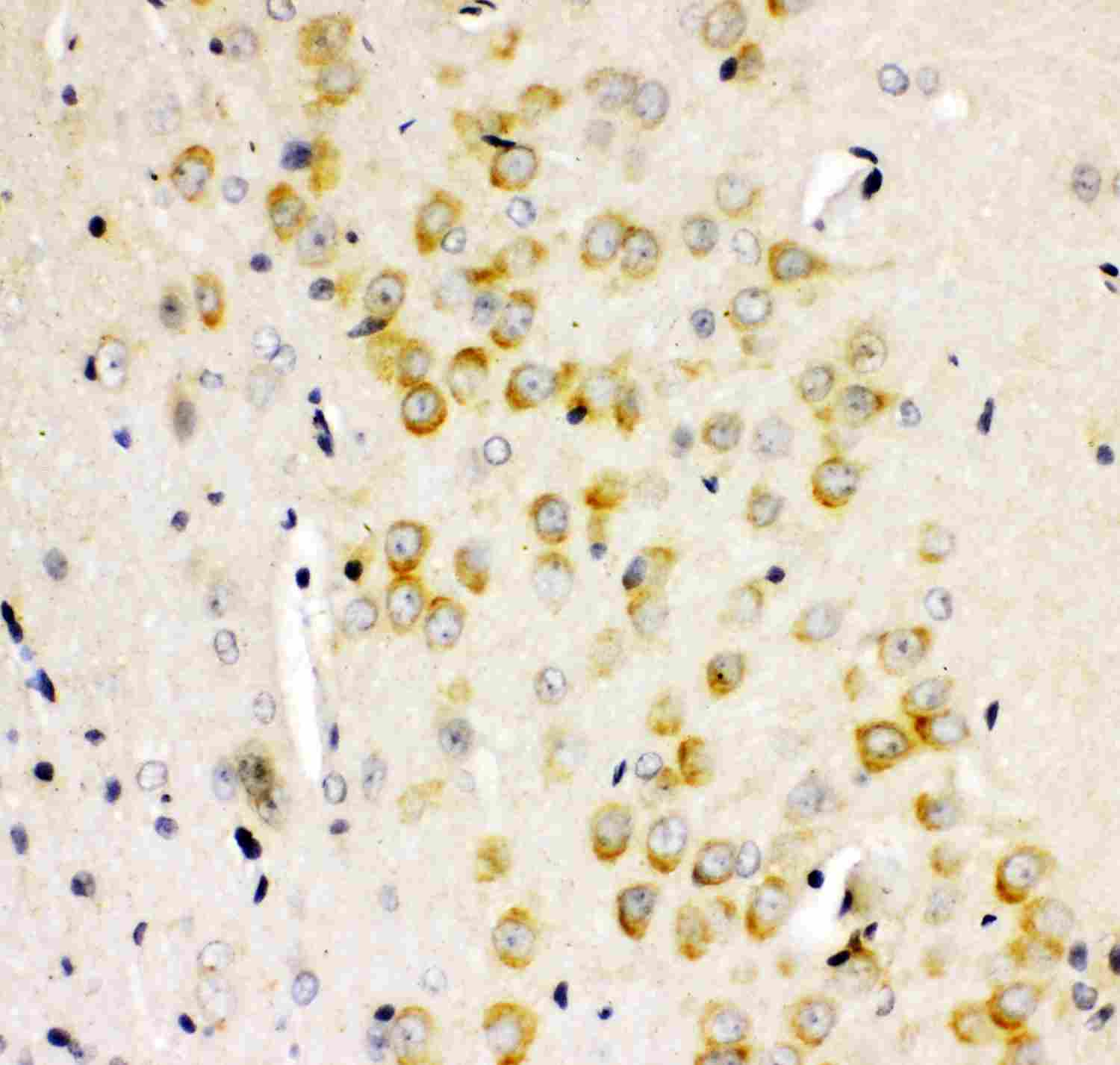 2 - Anti-GRIA2 Picoband Antibody ABO11896