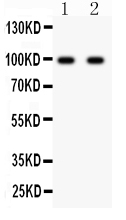 1 - Anti-GRIA2 Picoband Antibody ABO11896
