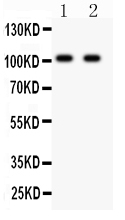 1 - Anti-GRIA3 Picoband Antibody ABO11897