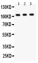 1 - Anti-GRIK1 Picoband Antibody ABO11899