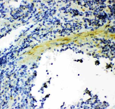 2 - Anti-Gelsolin Picoband Antibody ABO11900