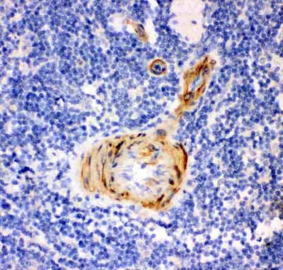 2 - Anti-Gelsolin Picoband Antibody ABO11900
