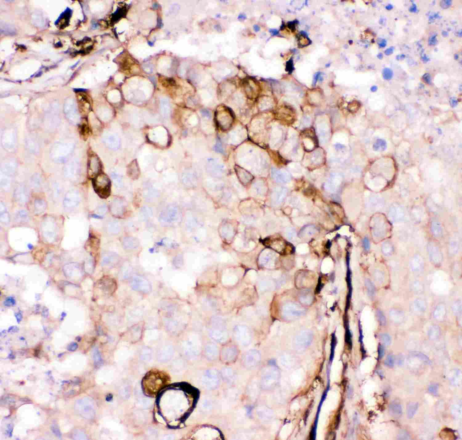 2 - Anti-Gelsolin Picoband Antibody ABO11900