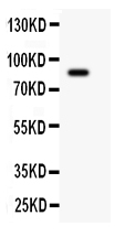 1 - Anti-Gelsolin Picoband Antibody ABO11900