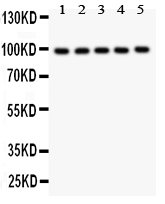 1 - Anti-HCN1 Picoband Antibody ABO11901