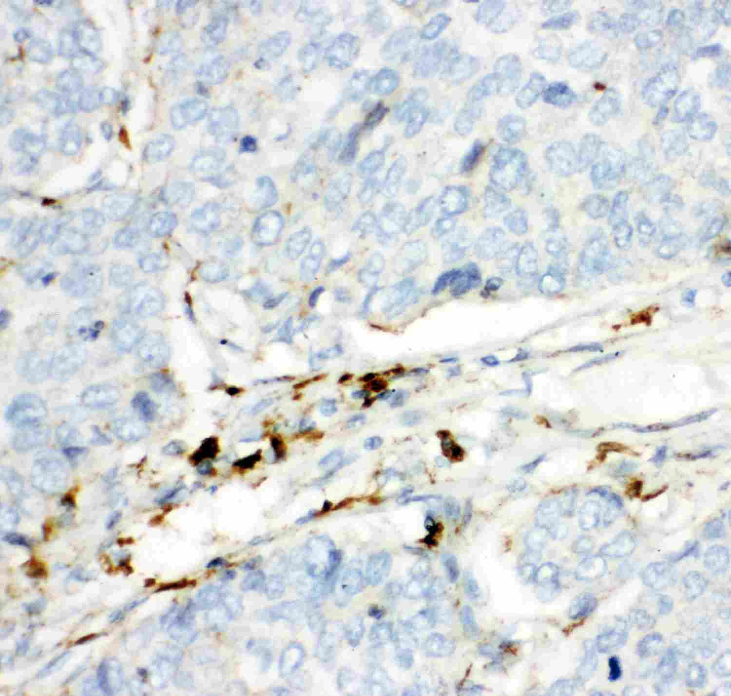2 - Anti-HEXB Picoband Antibody ABO11902