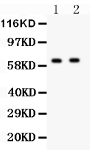 1 - Anti-HEXB Picoband Antibody ABO11902