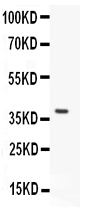 1 - Anti-HO-1/HMOX1 Antibody ABO11903