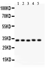 1 - Anti-HO-1/HMOX1 Antibody ABO11903