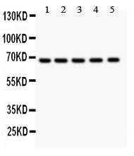 1 - Anti-HNF1 Picoband Antibody ABO11905