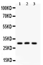 1 - Anti-HOXA9 Picoband Antibody ABO11907