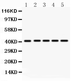 1 - Anti-HOXA10 Picoband Antibody ABO11908