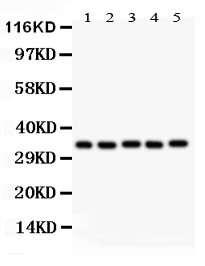 1 - Anti-HOXA11 Picoband Antibody ABO11909