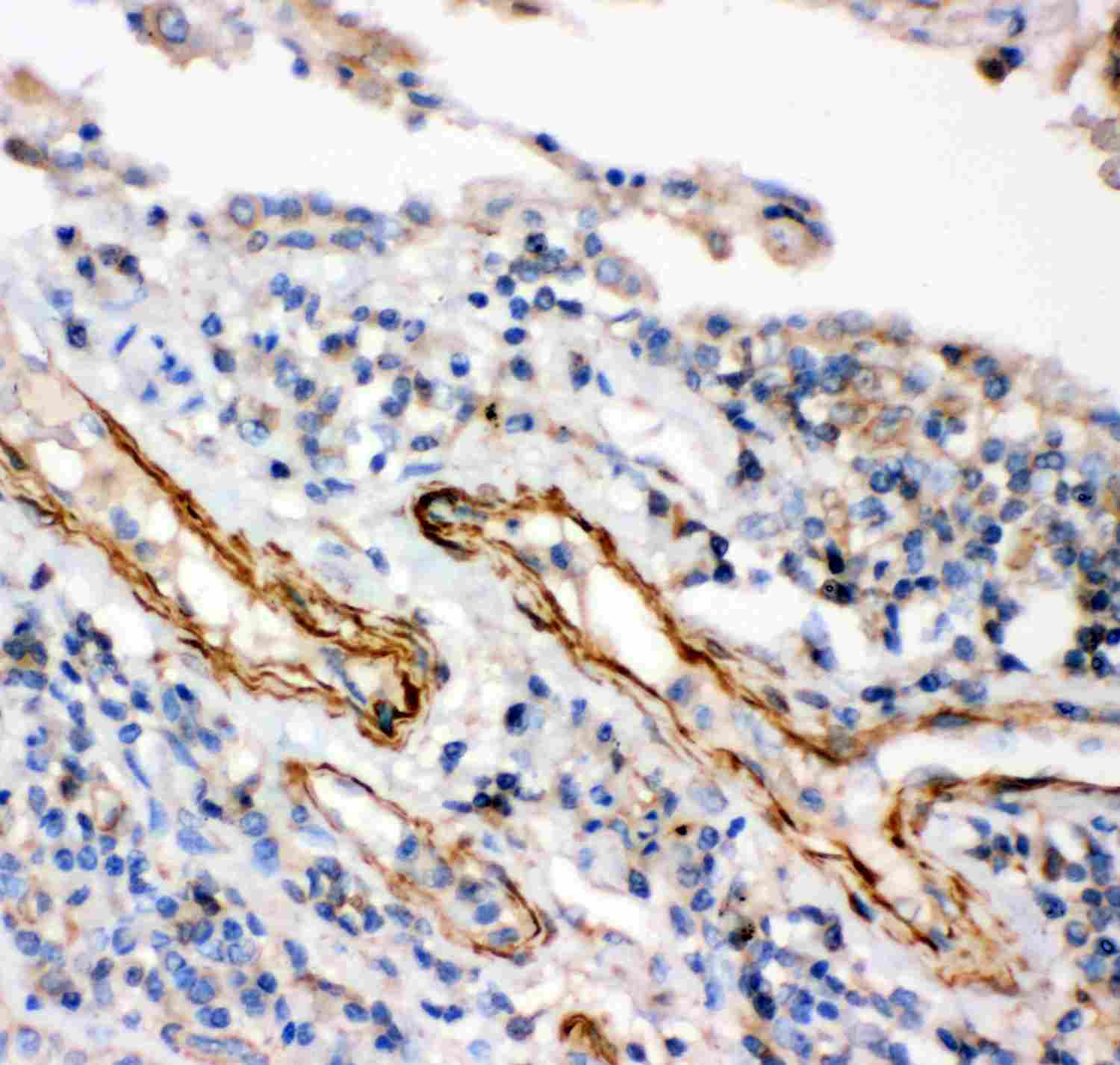 2 - Anti-IKK Beta Picoband Antibody ABO11912