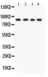 1 - Anti-IKK Beta Picoband Antibody ABO11912