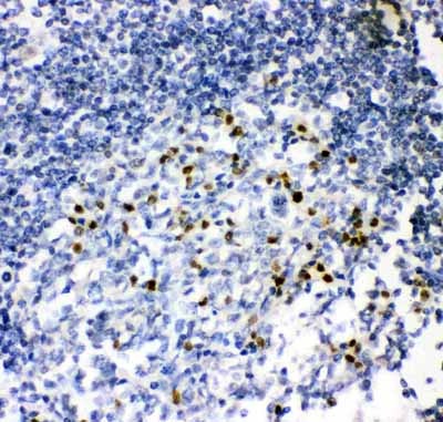 2 - Anti-MUM1 Picoband Antibody ABO11913