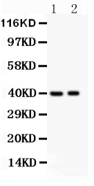 1 - Anti-MUM1 Picoband Antibody ABO11913