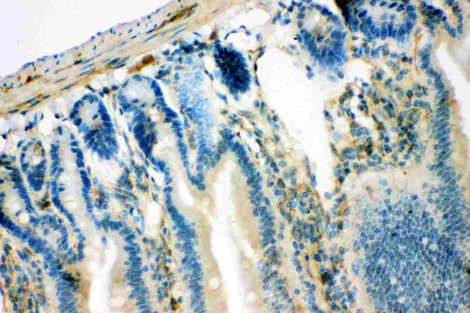 2 - Anti-IRS1 Picoband Antibody ABO11914