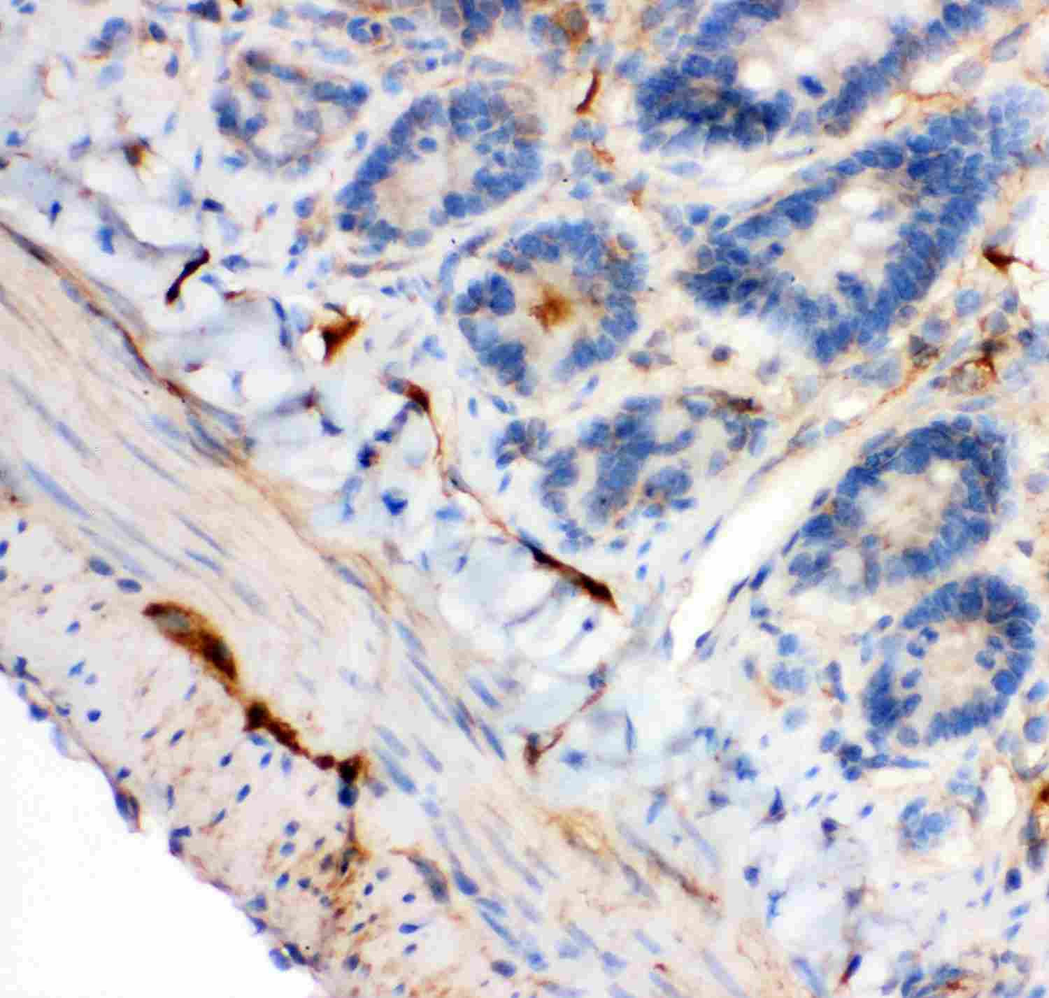2 - Anti-IRS1 Picoband Antibody ABO11914