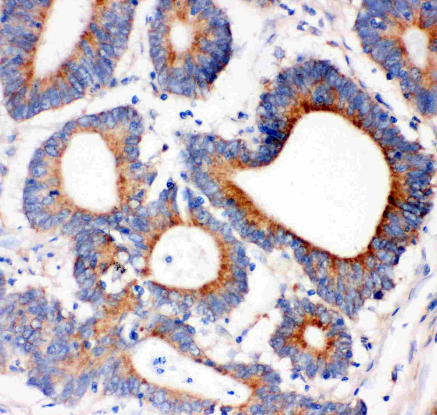 2 - Anti-IRS1 Picoband Antibody ABO11914