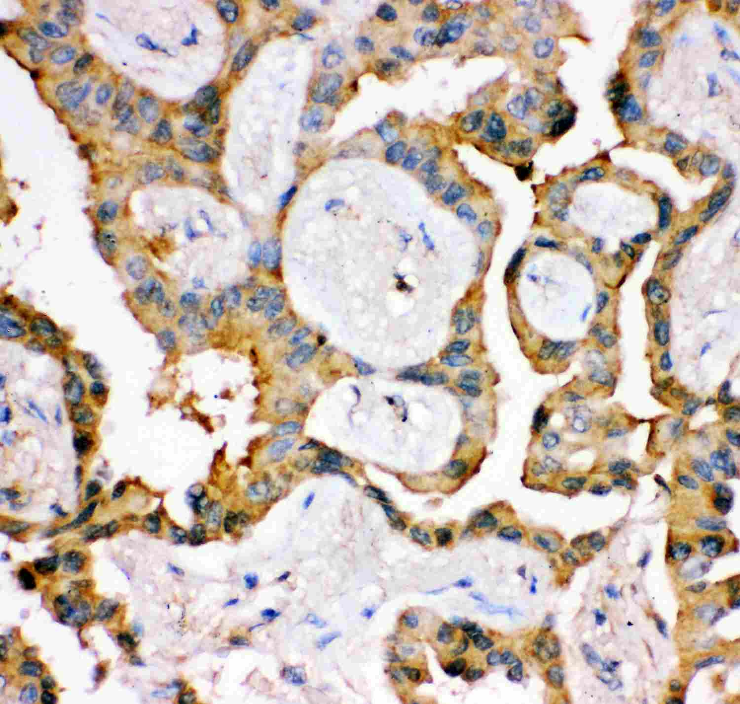 2 - Anti-IRS1 Picoband Antibody ABO11914