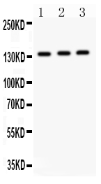 1 - Anti-IRS1 Picoband Antibody ABO11914