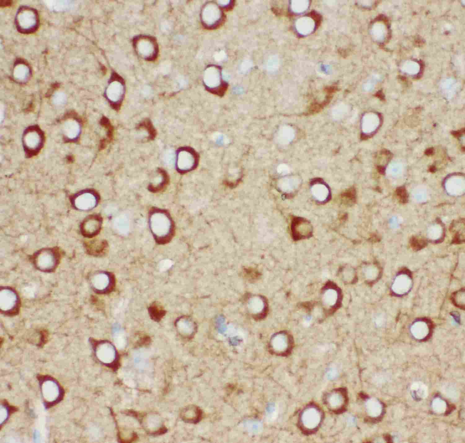 2 - Anti-IP3 Receptor Picoband Antibody ABO11916