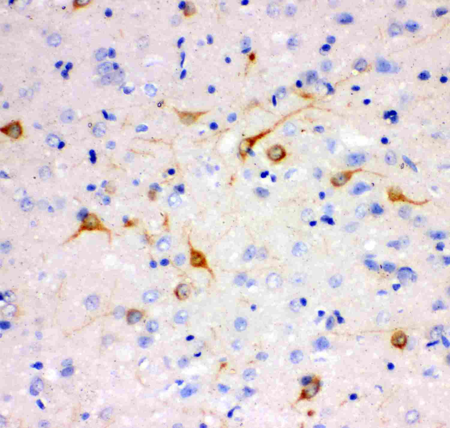 2 - Anti-IP3 Receptor Picoband Antibody ABO11916