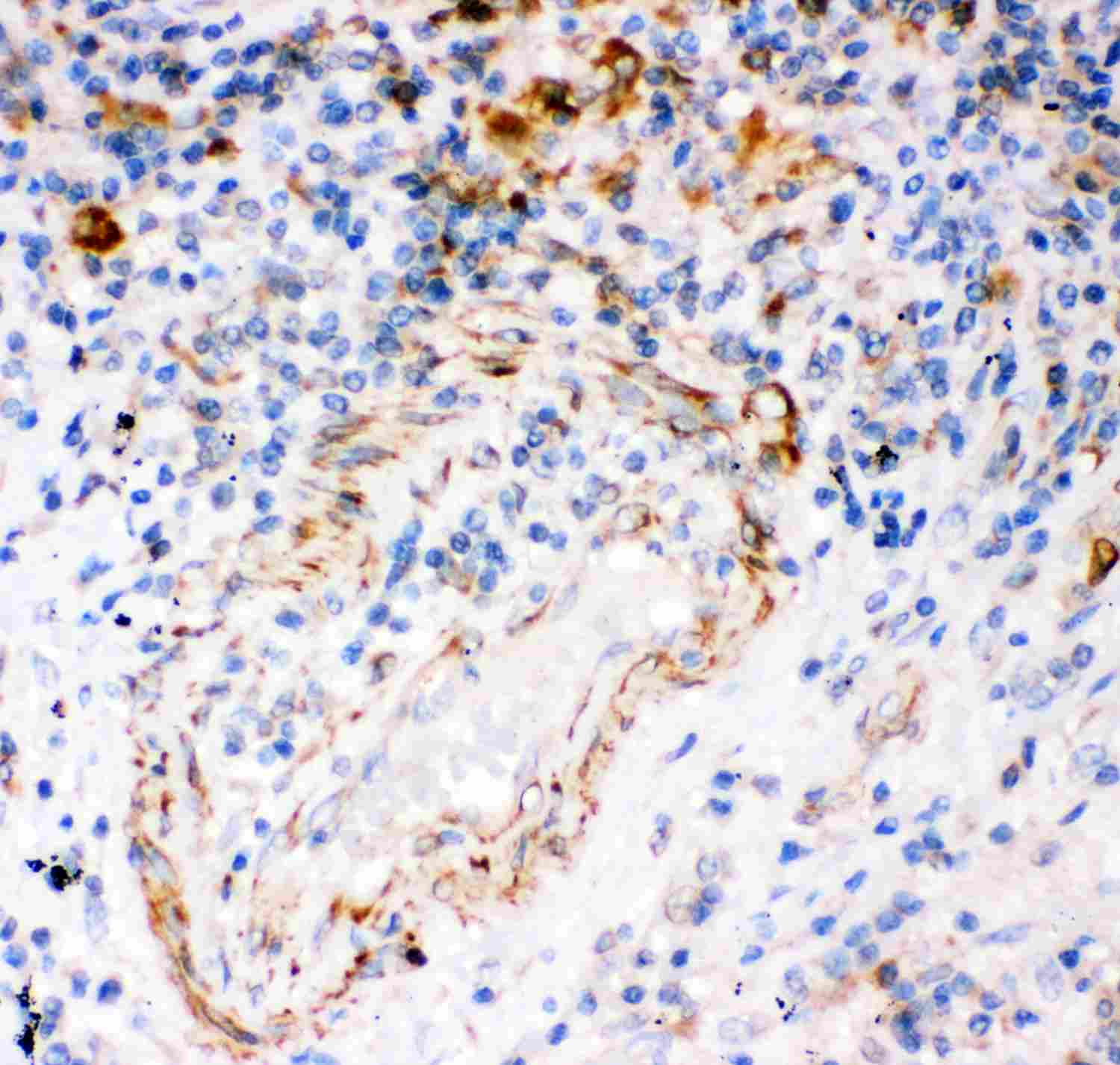 2 - Anti-IP3 Receptor Picoband Antibody ABO11916