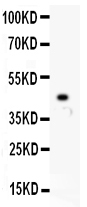 1 - Anti-IP3 Receptor Picoband Antibody ABO11916